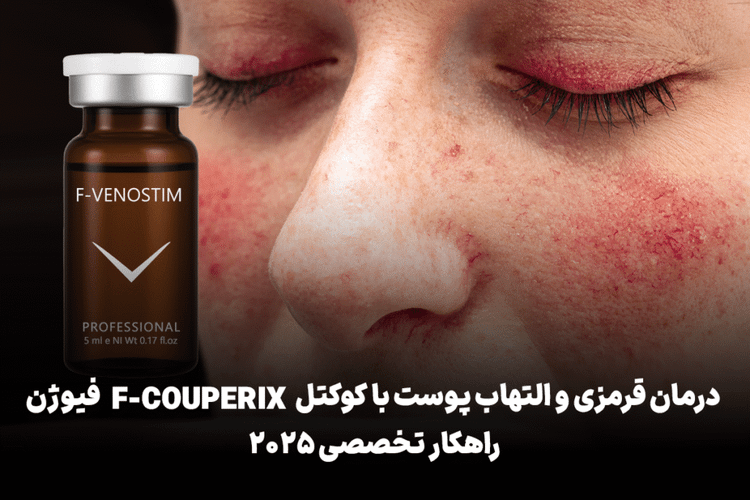 F-Couperix درمان قرمزی پوست و رگ های عنکبوتی و رزاسه