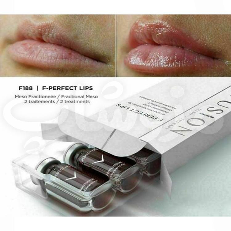 کوکتل حجم دهی به لب فیوژن F-PERFECT LIPS