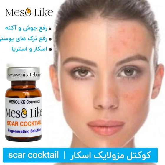 کوکتل مزولایک اسکار
